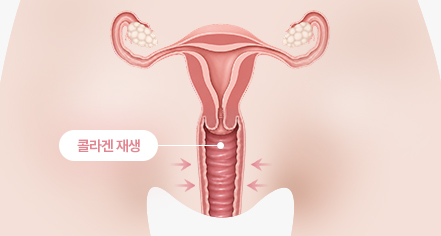 오르가니 시술 전 이미지