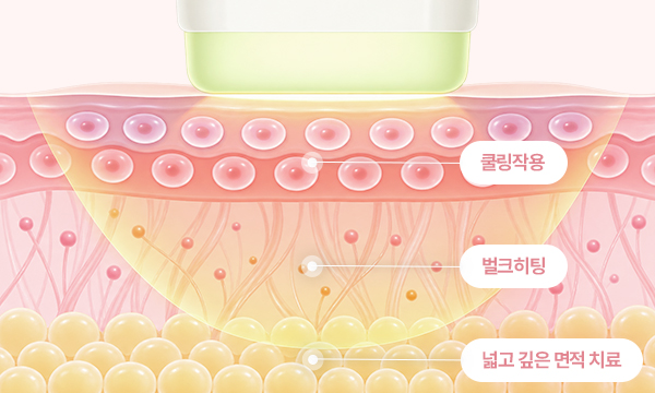 비비브 장비 효과 일러스트