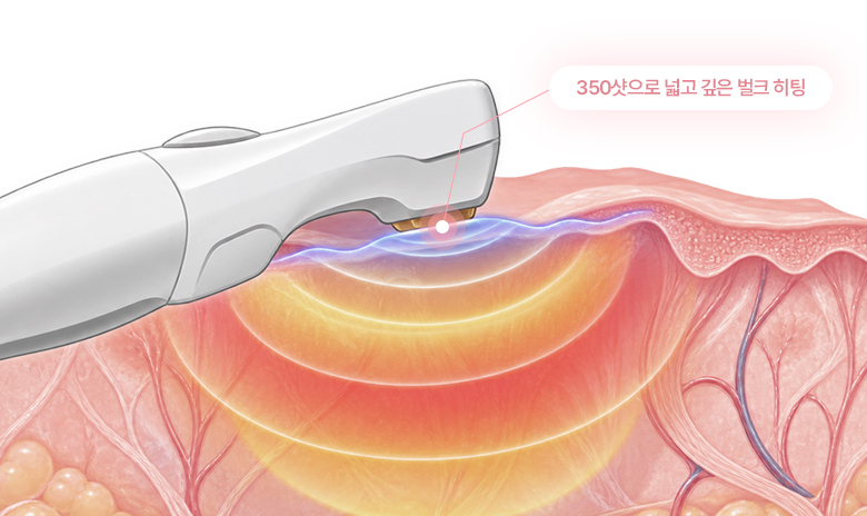 비비브2.0 디바이스 관련 설명 이미지